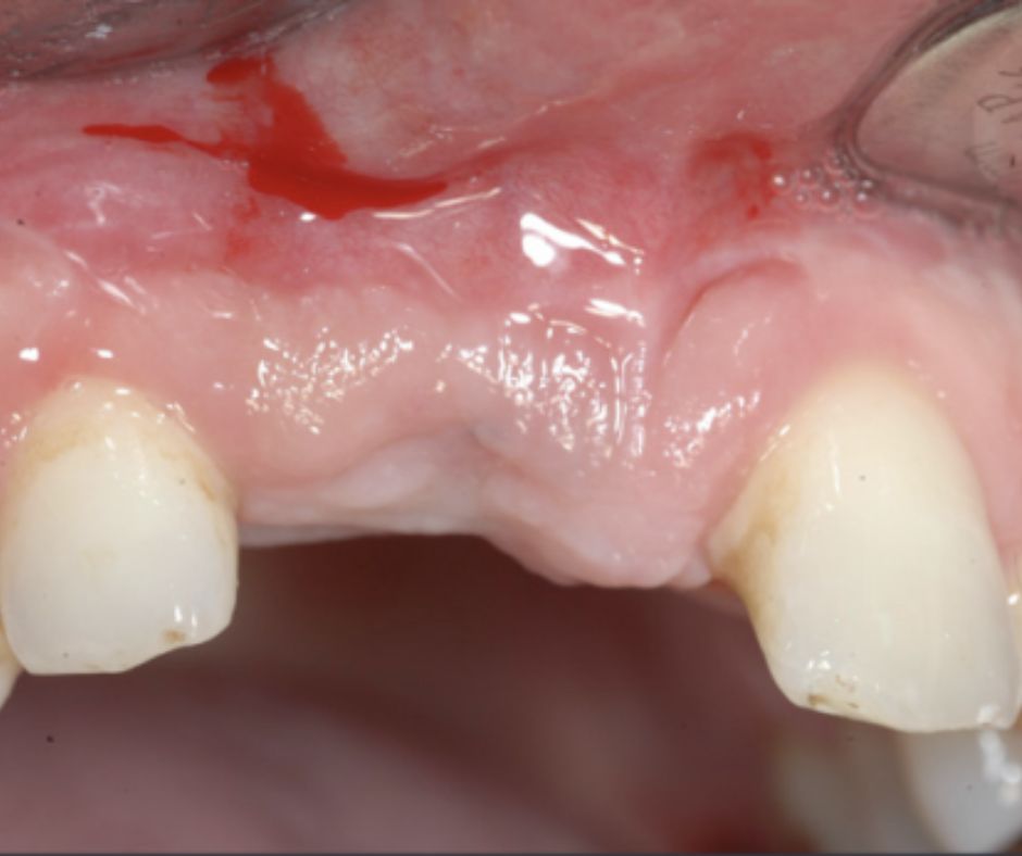 Case Report NeoGen Dr Hassfurther 11677_1