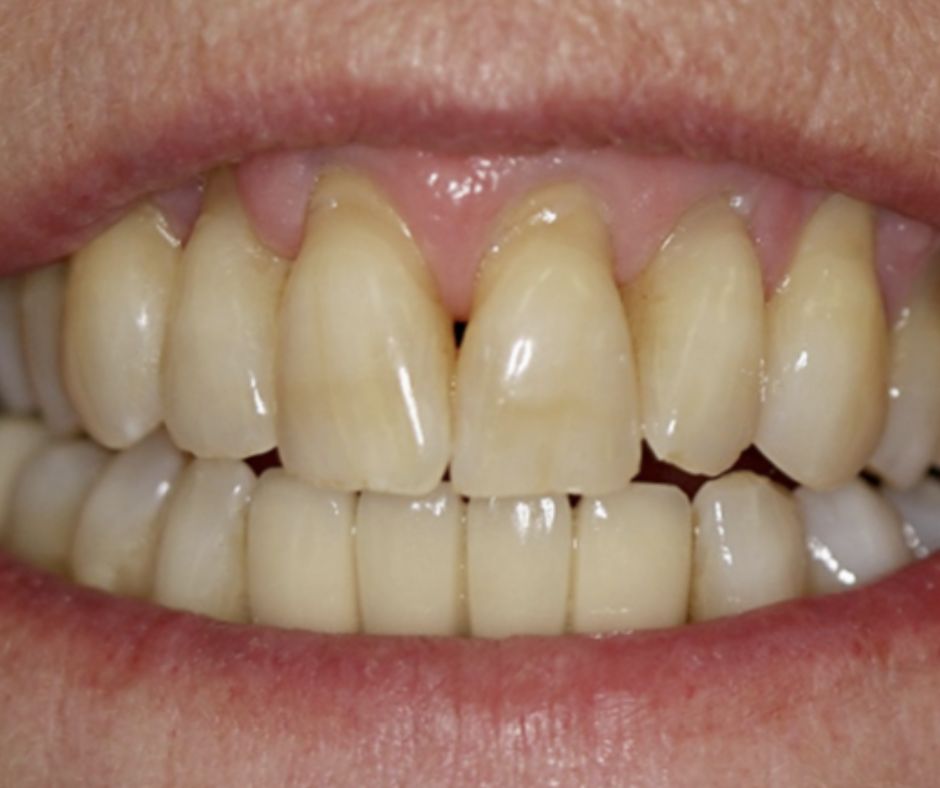 Case Report Neoss ProActive 3.25 Dr Uzel 14649_0