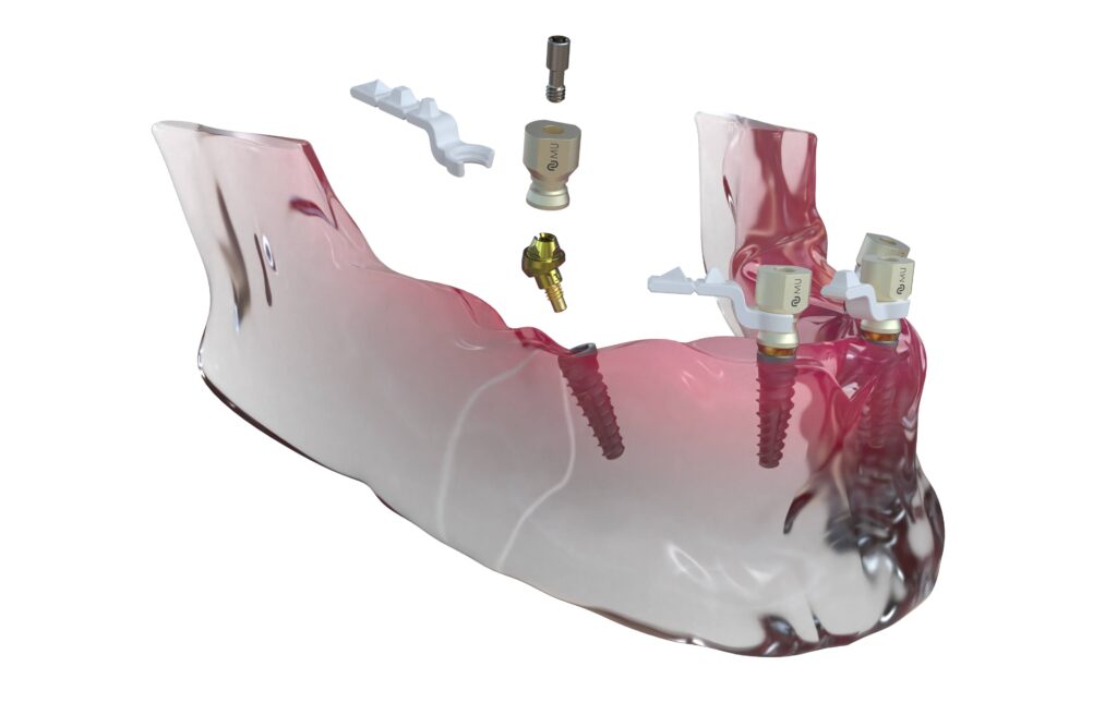 Neoss Scan Body Scanning Full arch flexibility with Neoss4+