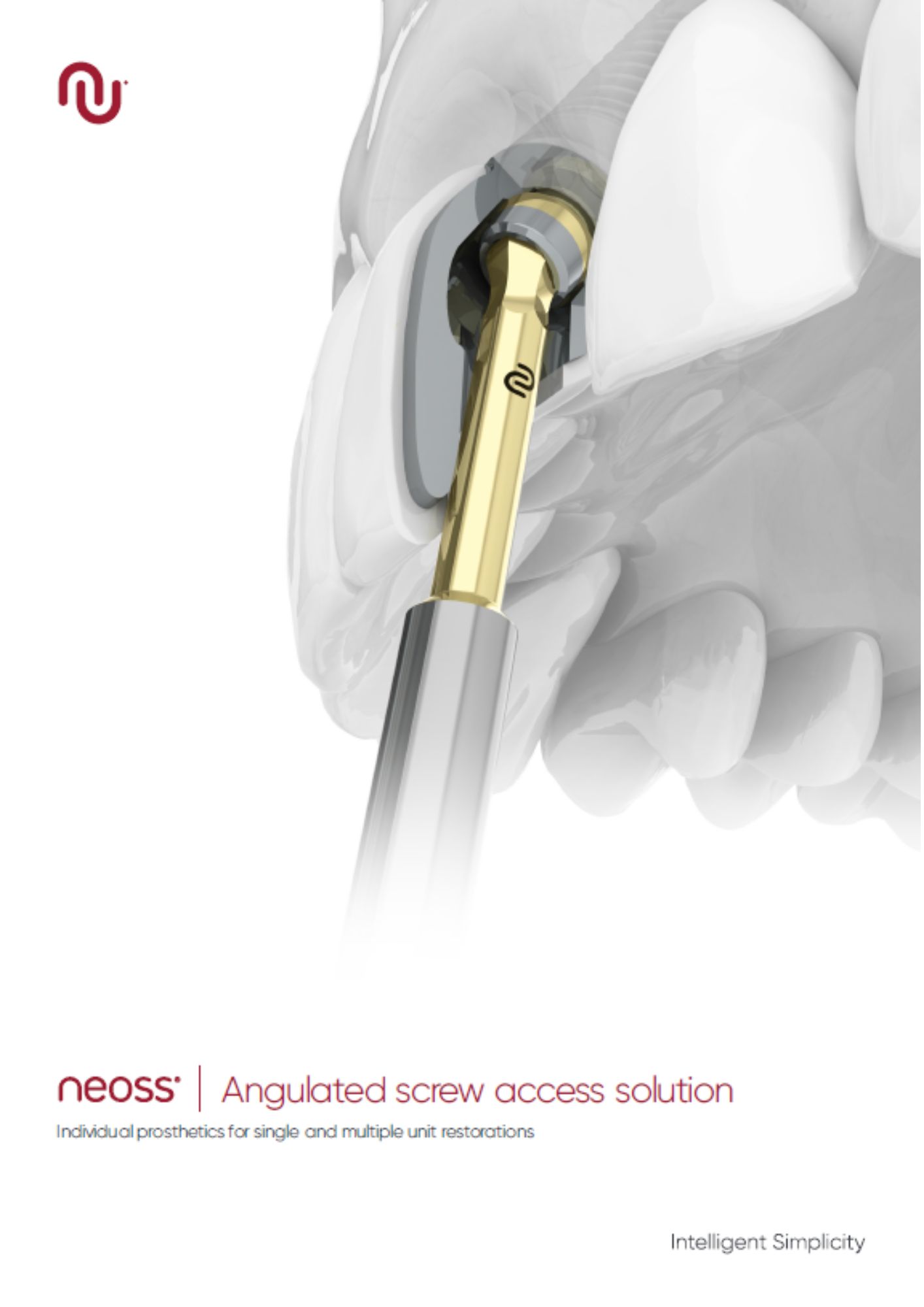 Neoss Angulated Solutions