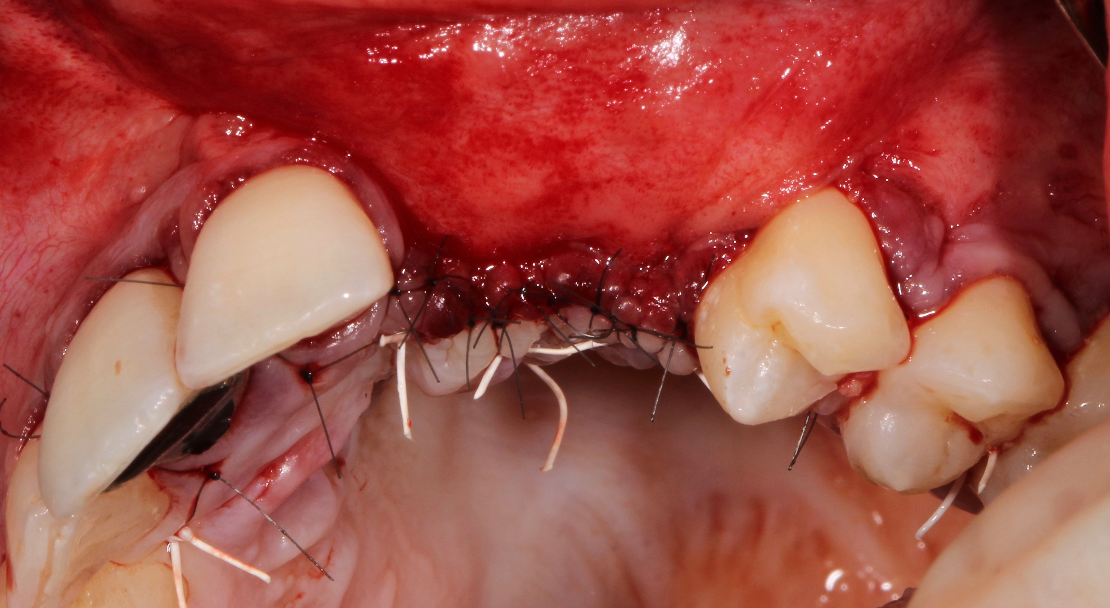 Figure 10. 