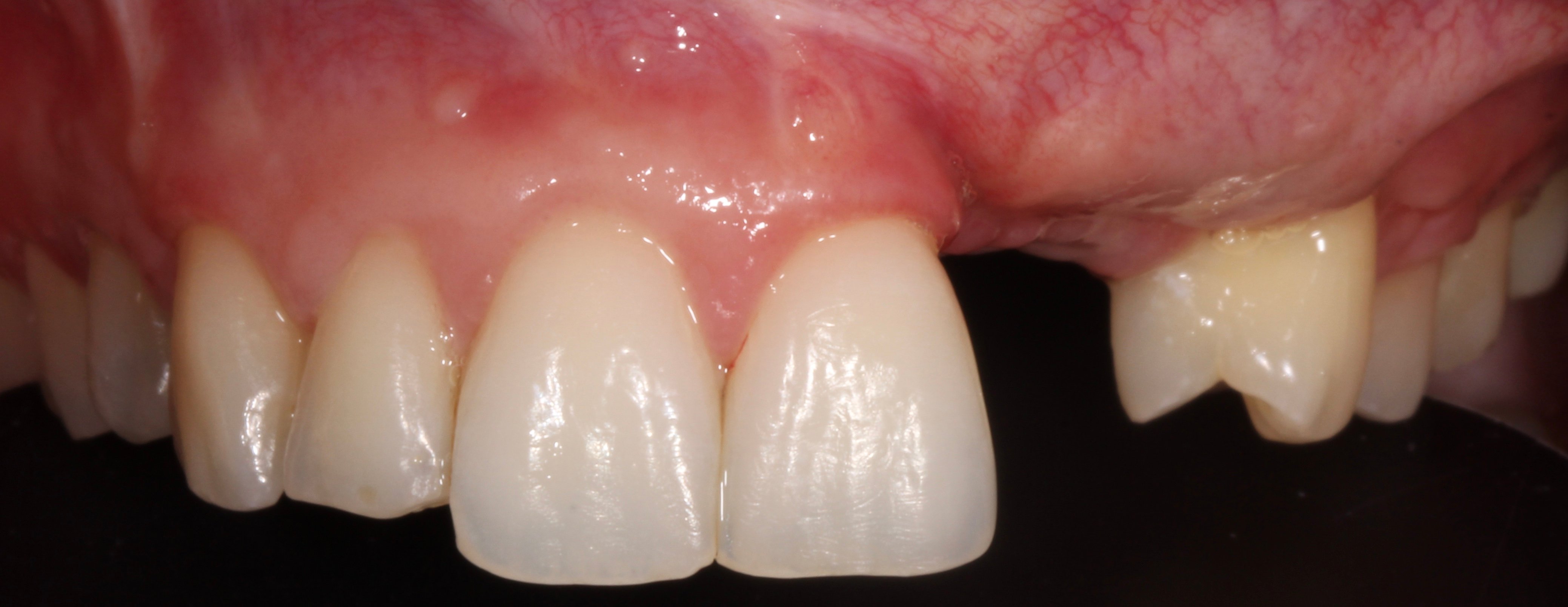 Figure 11. 