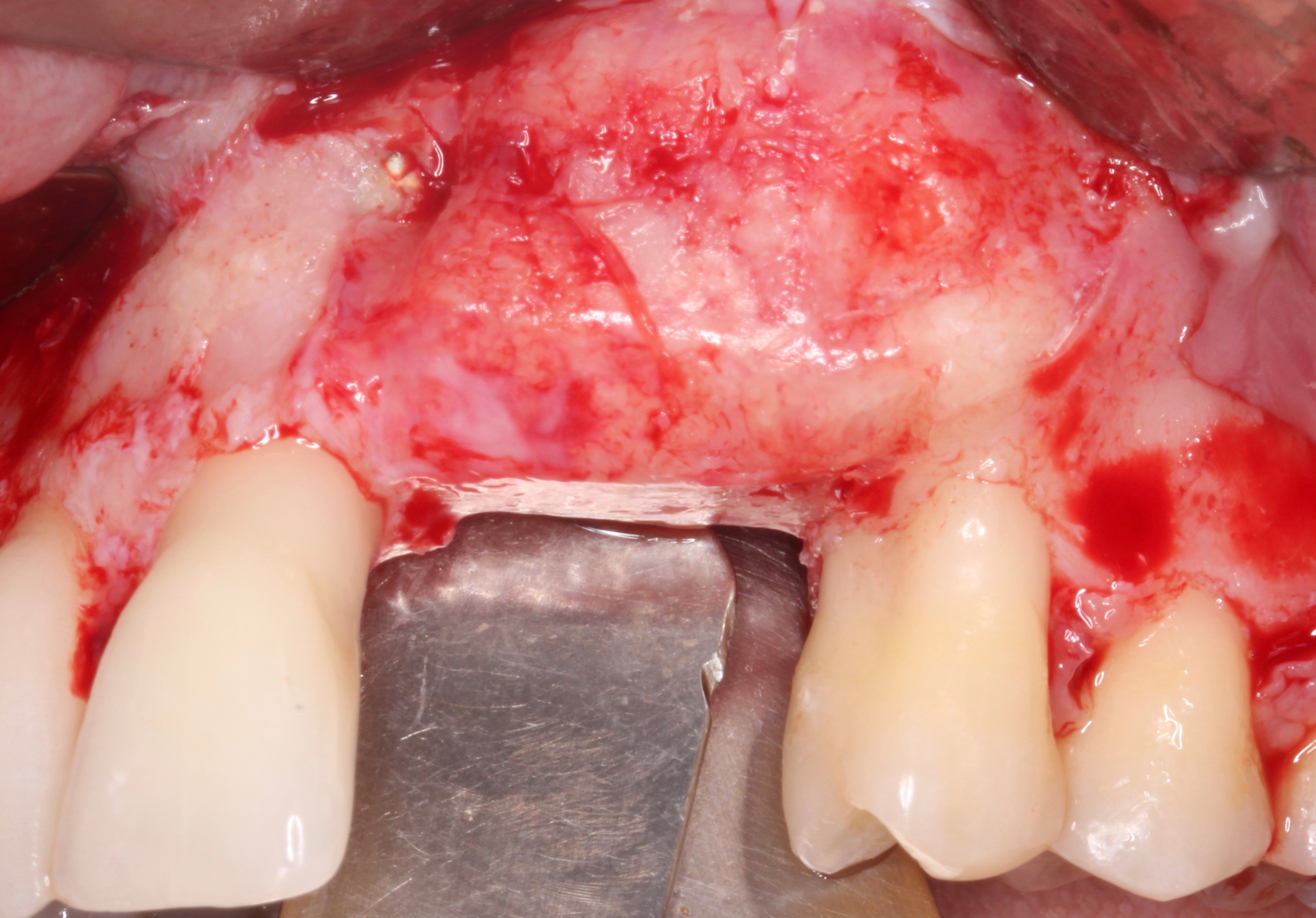 Figure 12. 