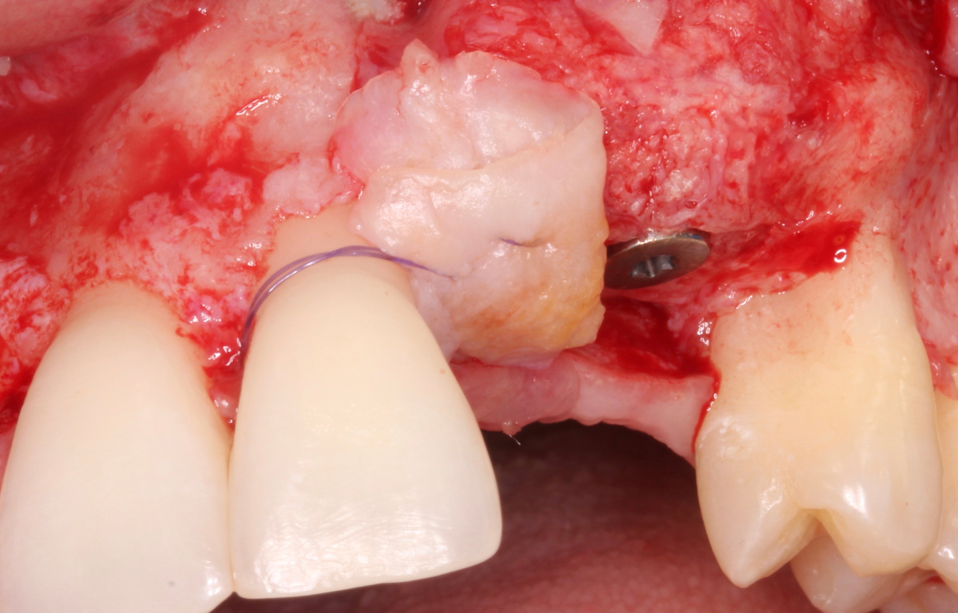 Figure 15. 
