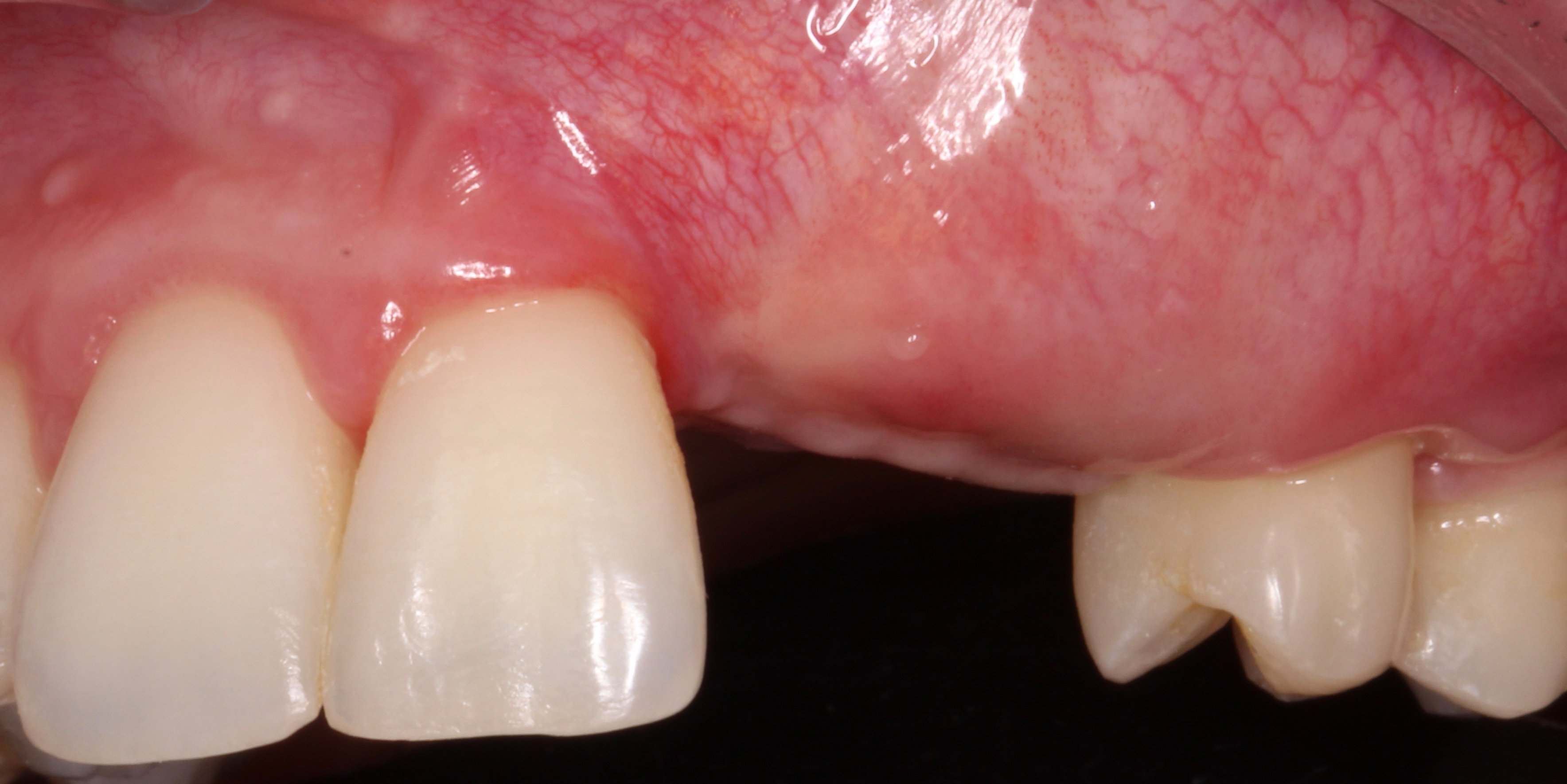 Figure 16. 