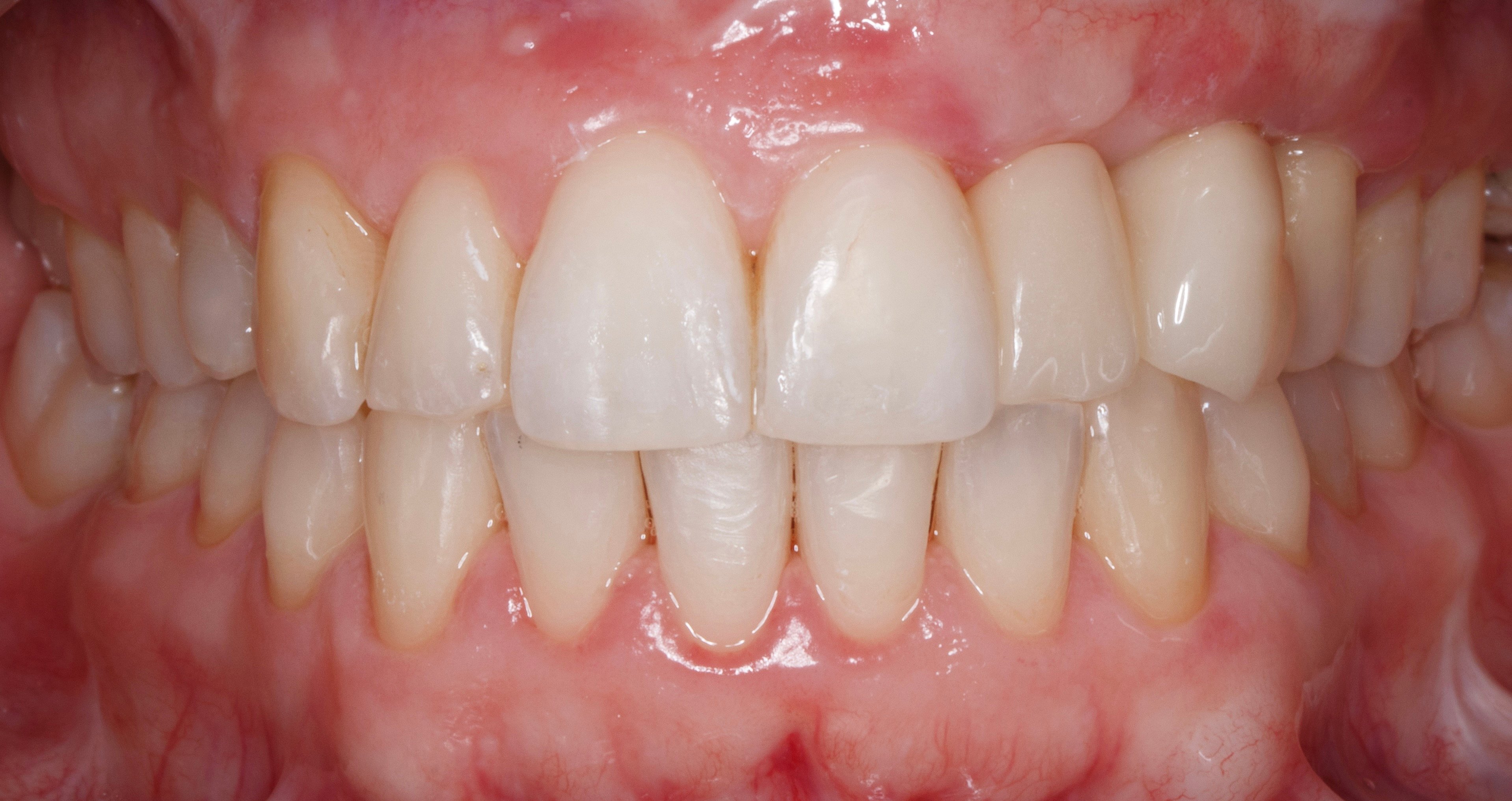 Figure 18. 