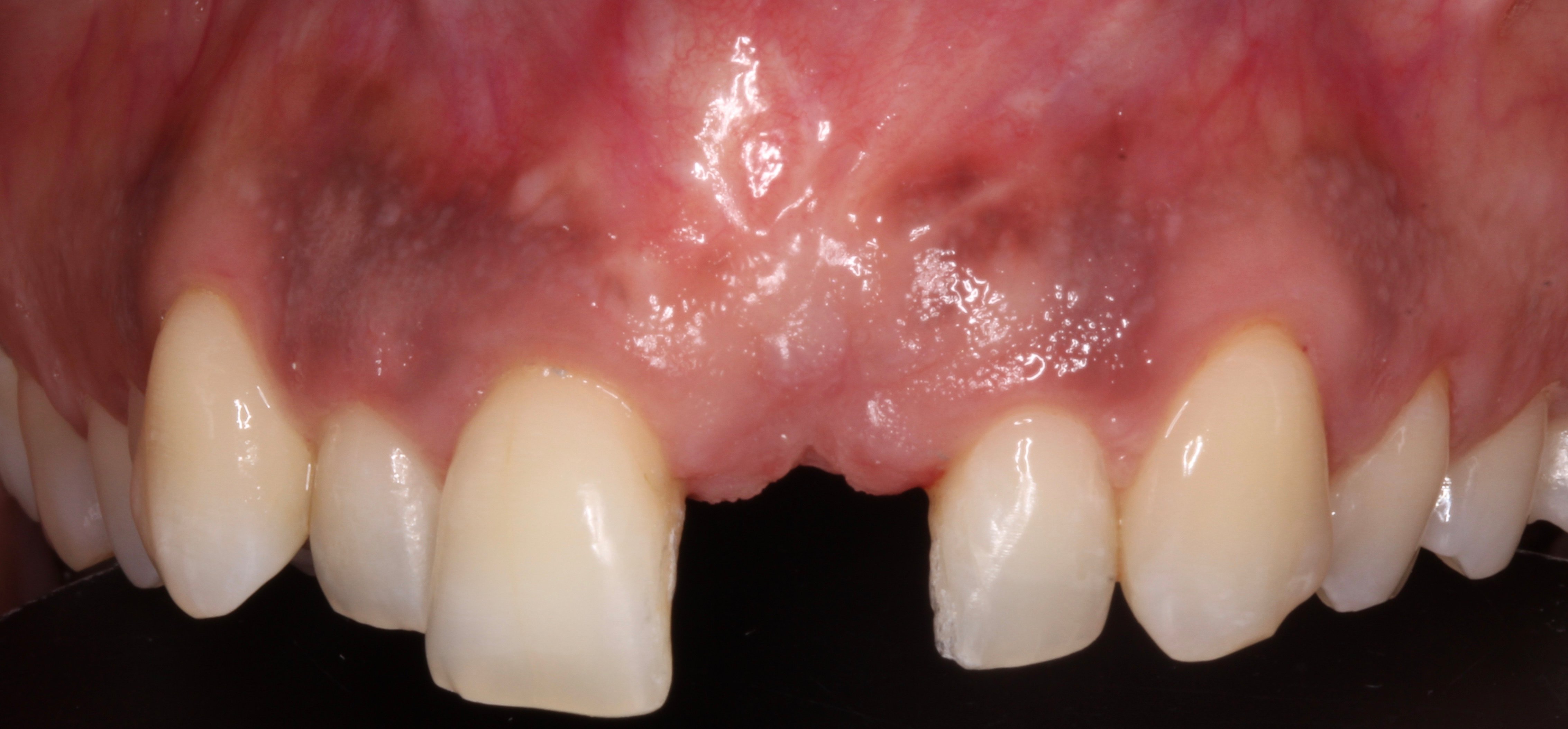 Figure 10.