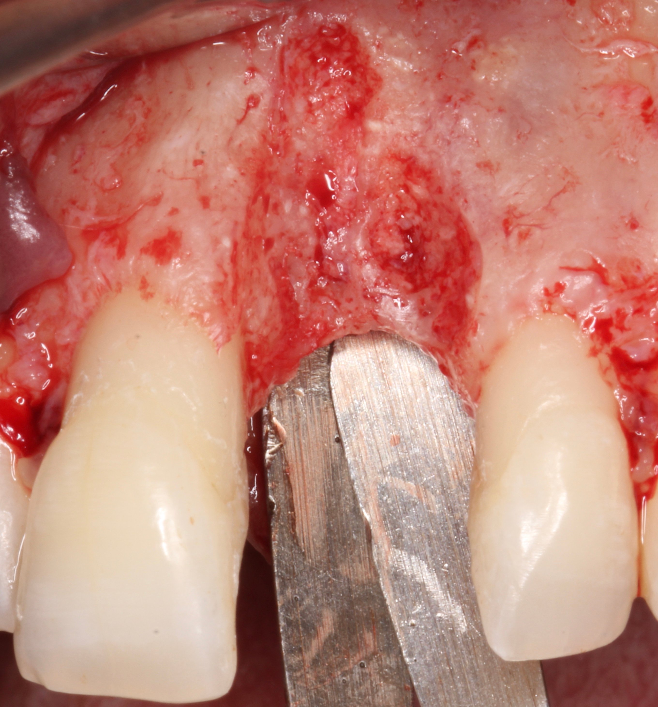 Figure 11.