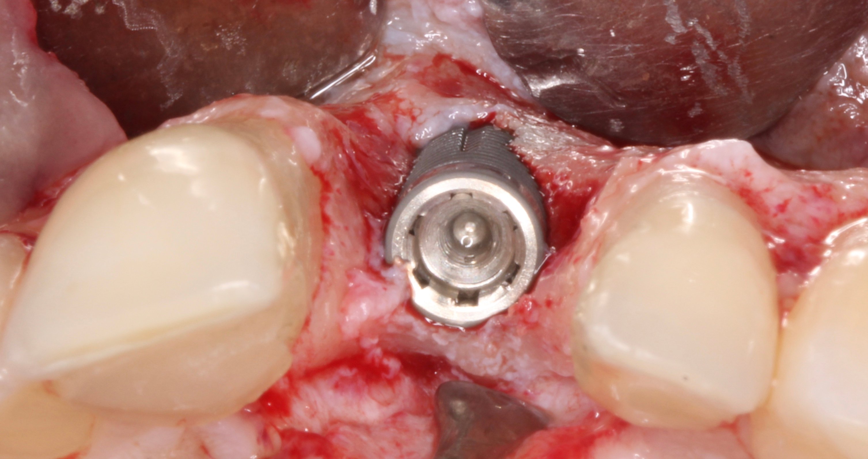 Figure 14.