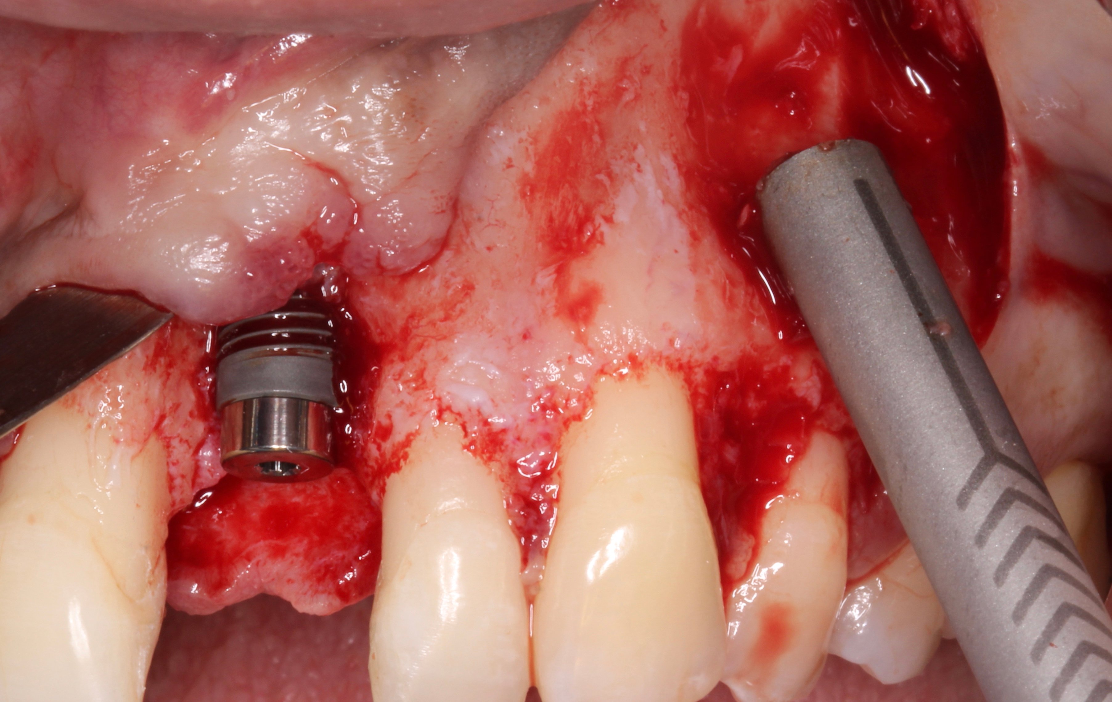 Figure 15.