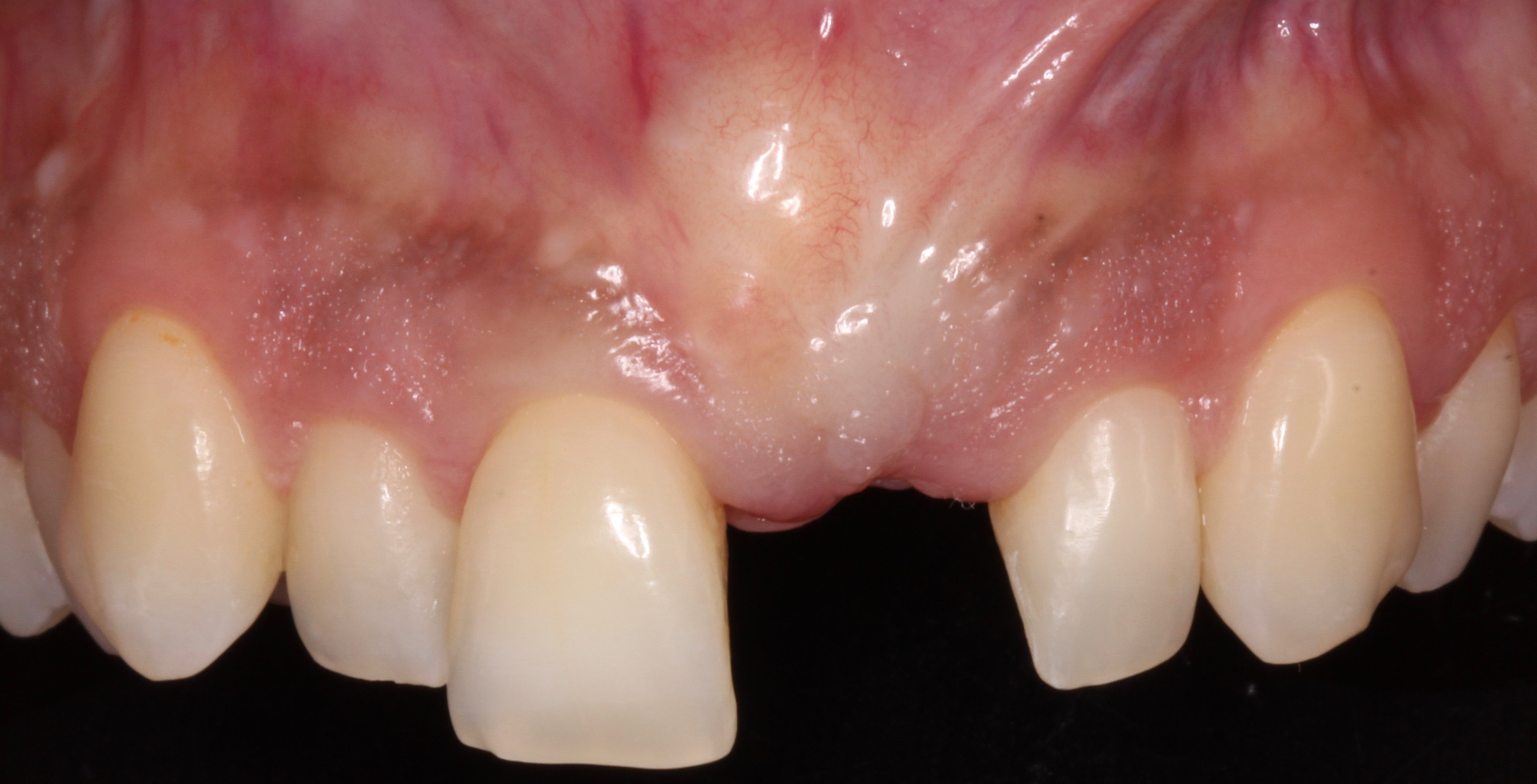 Figure 18.