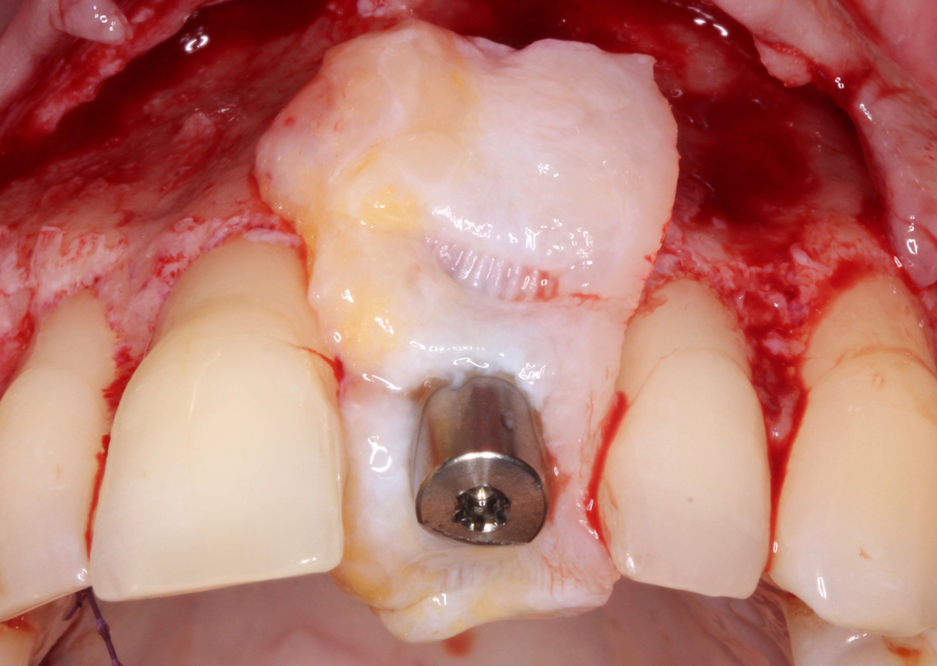 Figure 21.