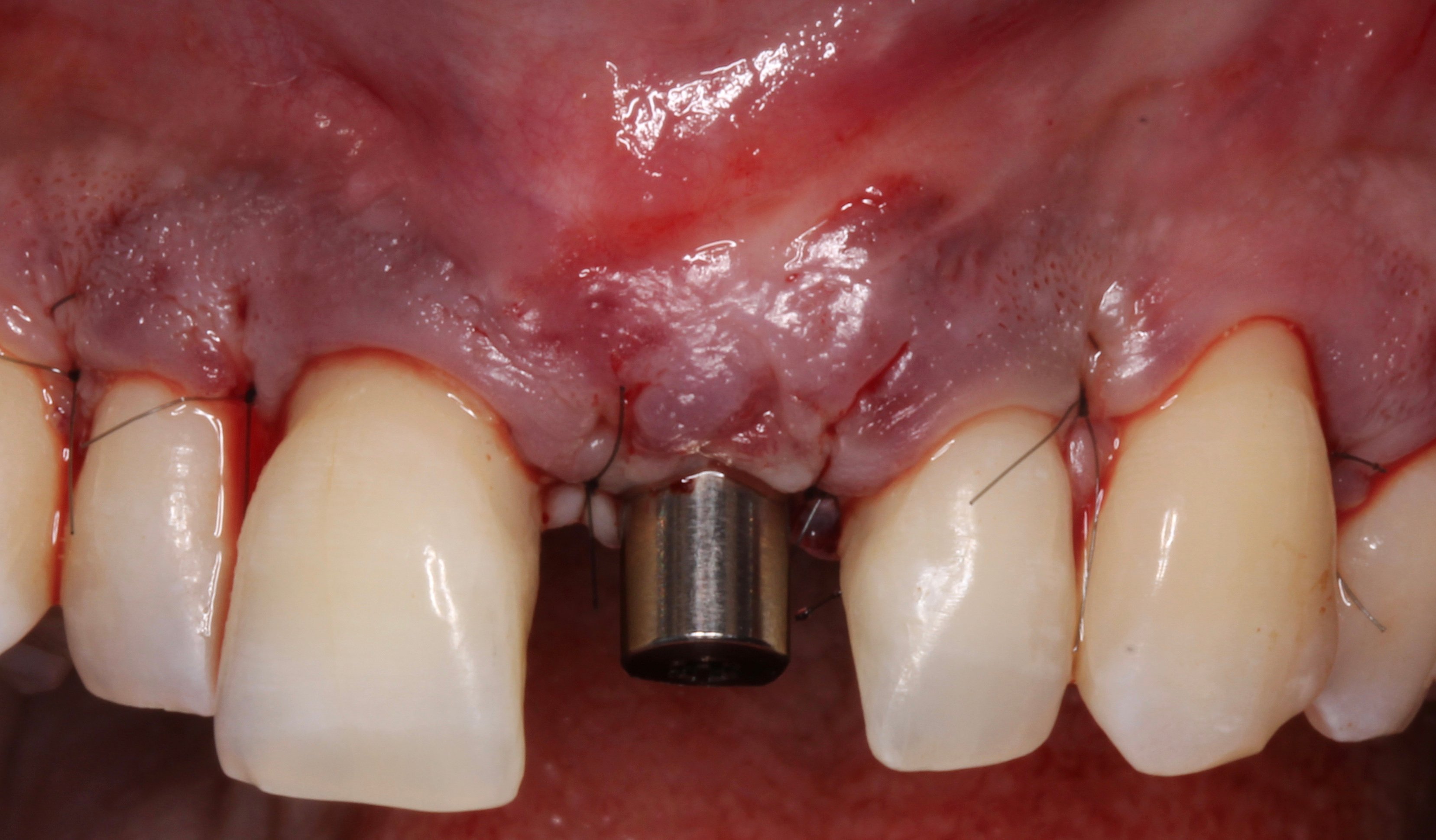 Figure 22.