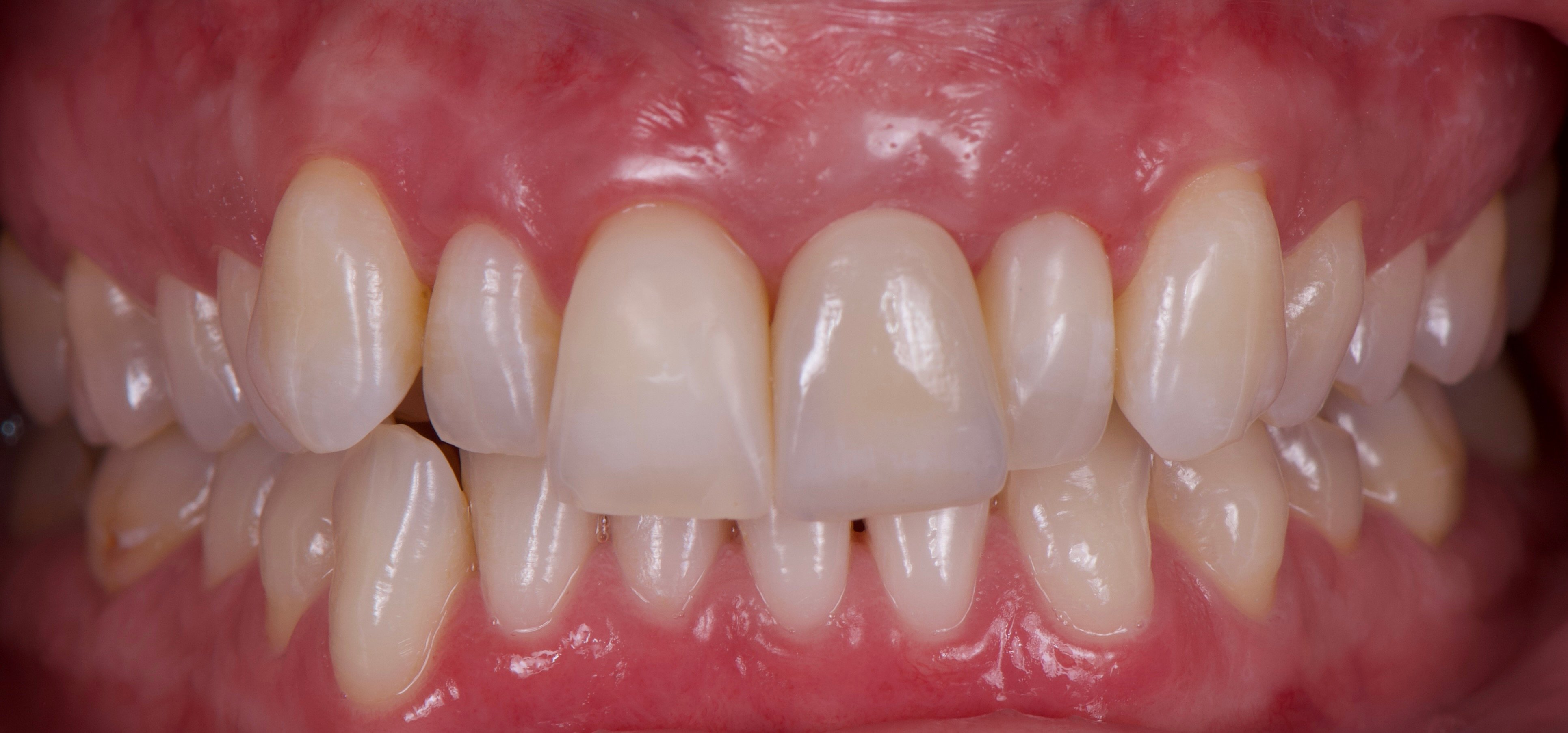 Figure 23.