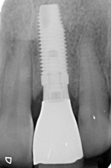 Figure 24.
