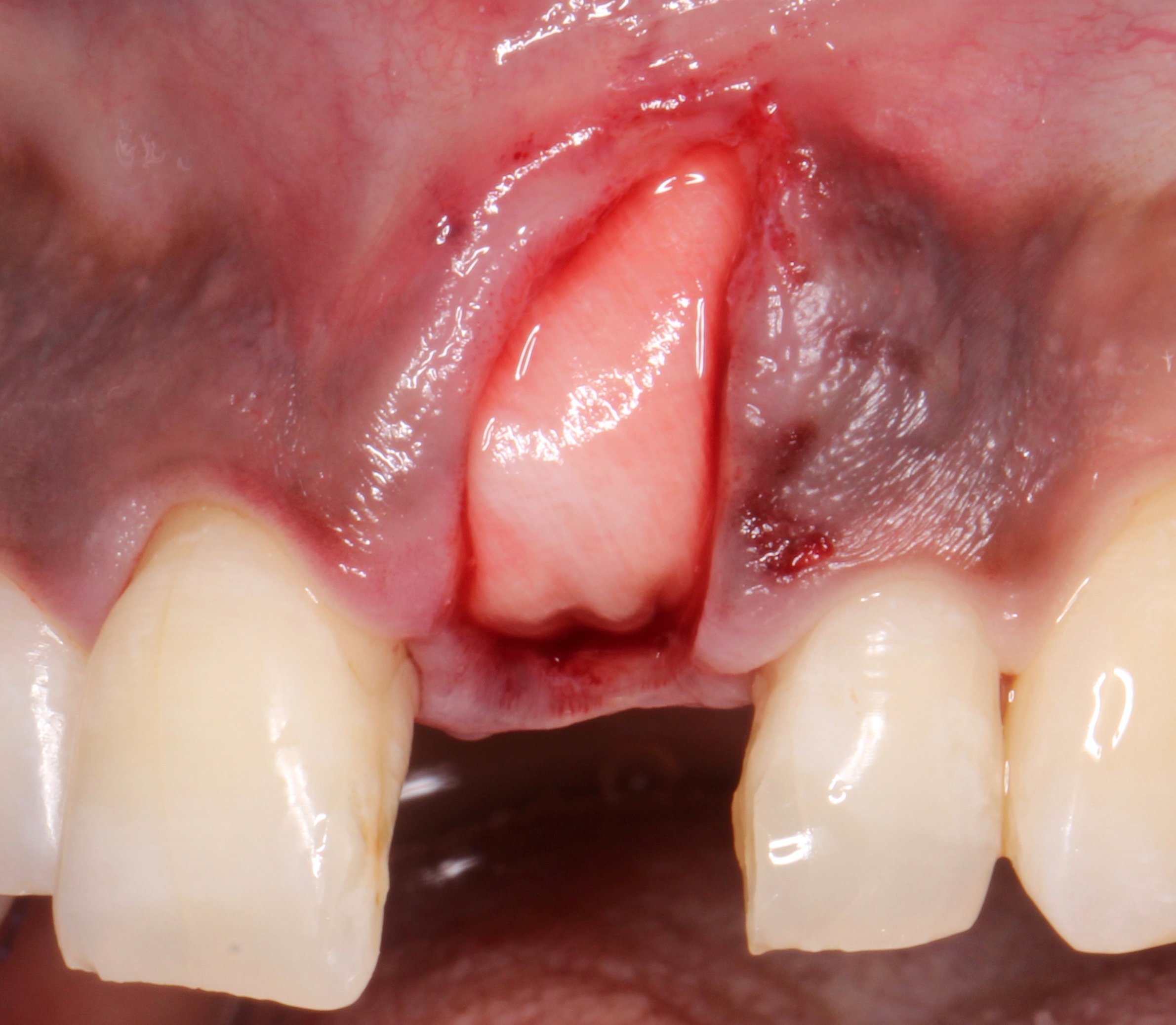 Figure 6.