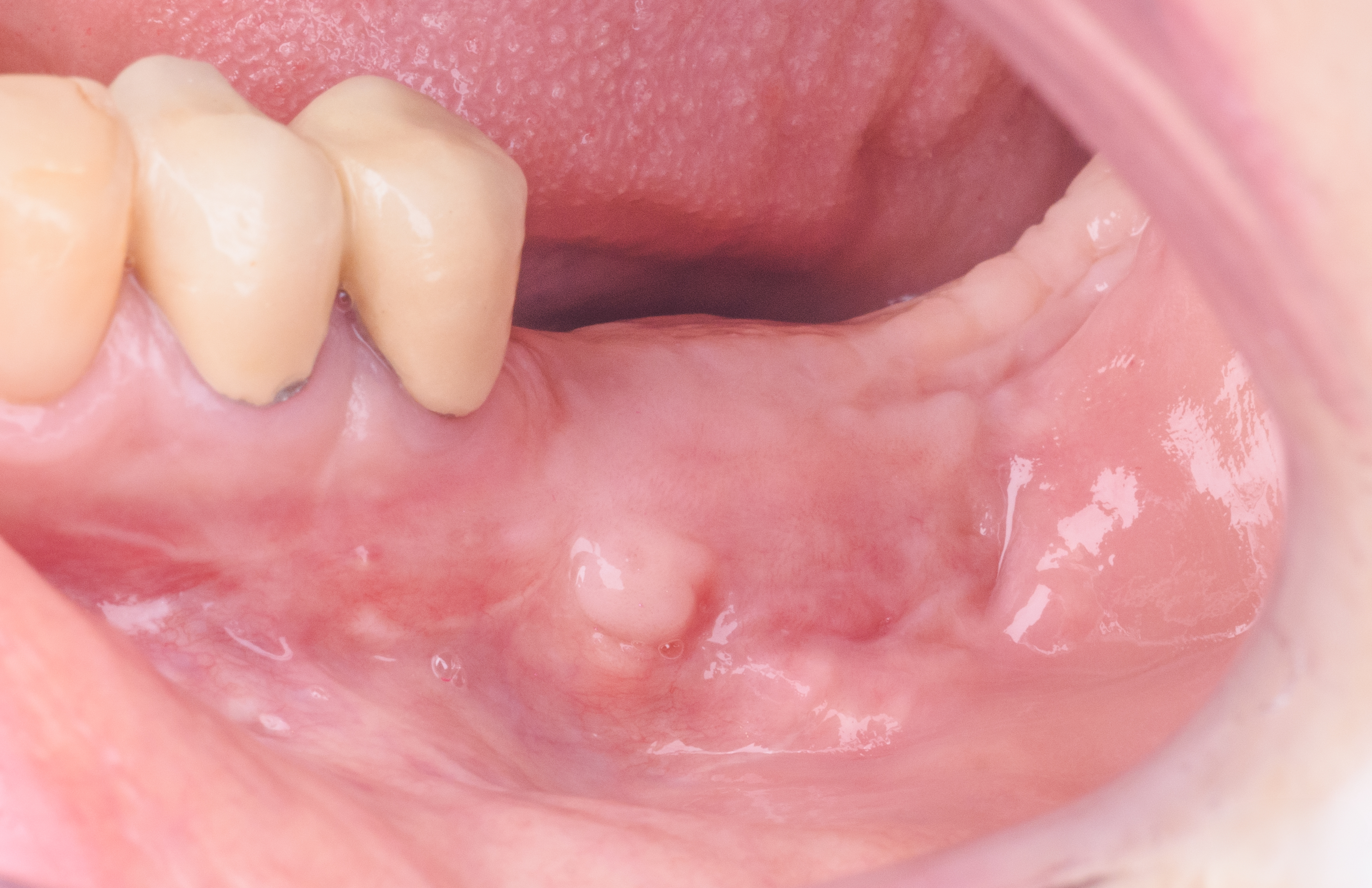 Figure 15.