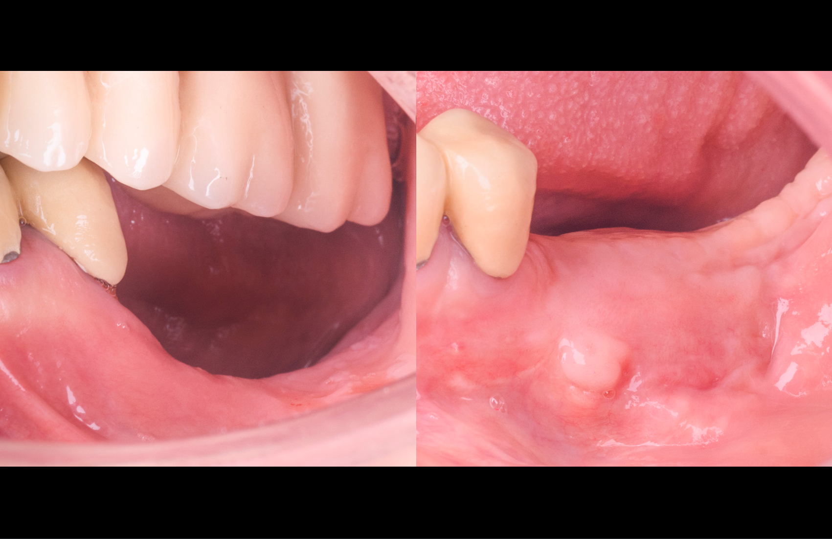 Figure 16.
