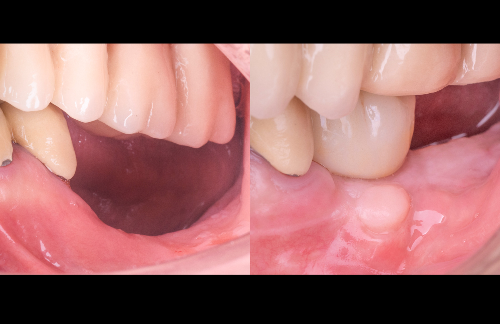 Figure 18.