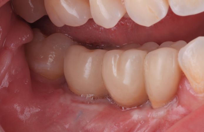 Figure 12.