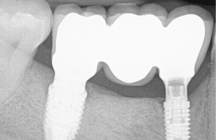 Figure 13.