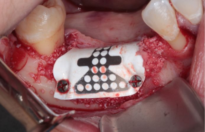 Figure 6.