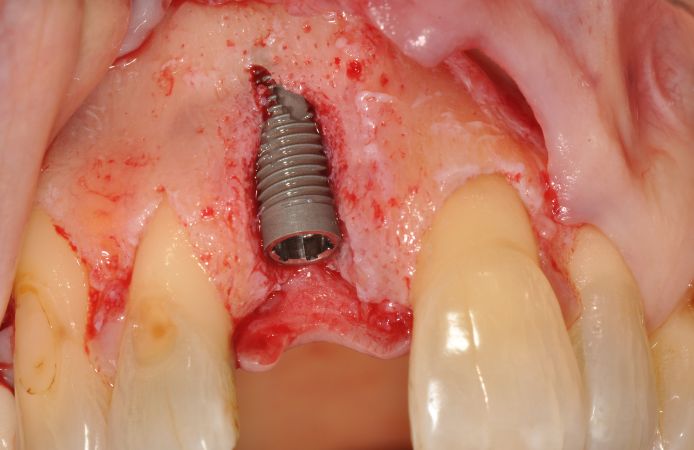 Figure 2.