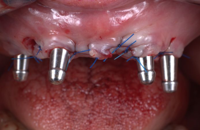 Figure 12.