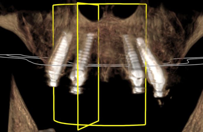 Figure 14.