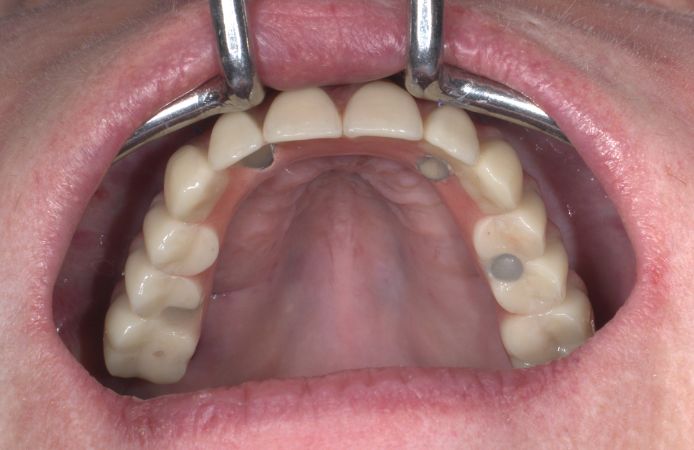 Figure 18.