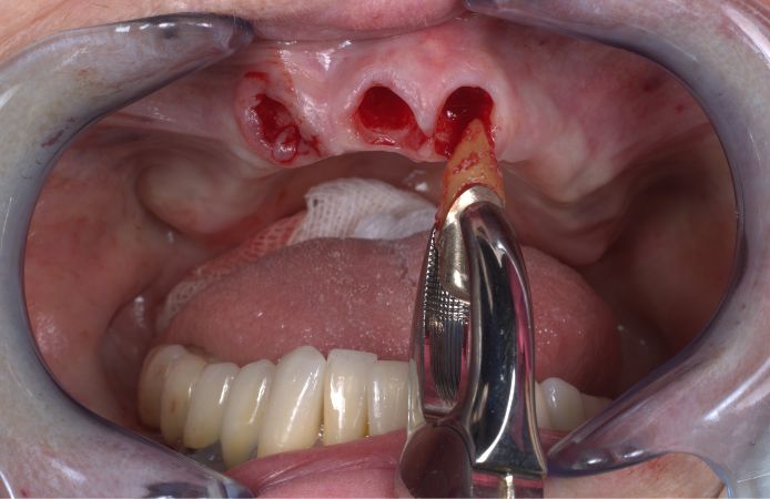Figure 3.
