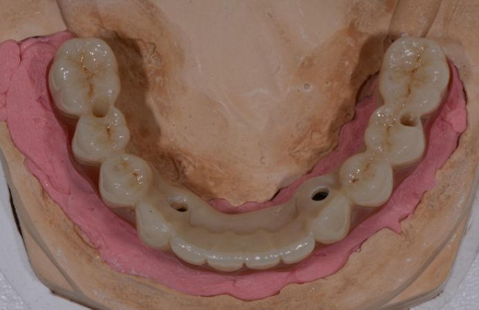 Figura 11.