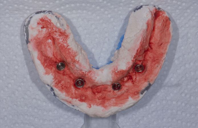 Figura 6.
