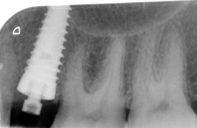 Figure 13.