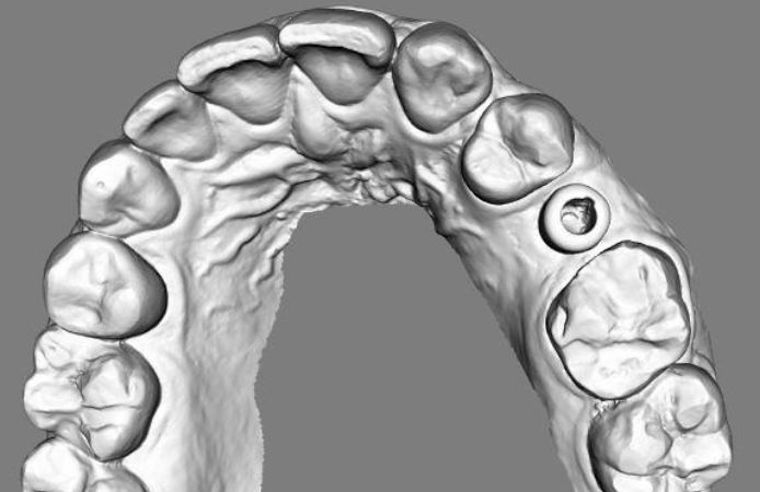 Figure 15.