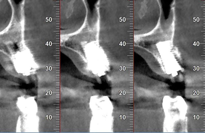 Figure 16.