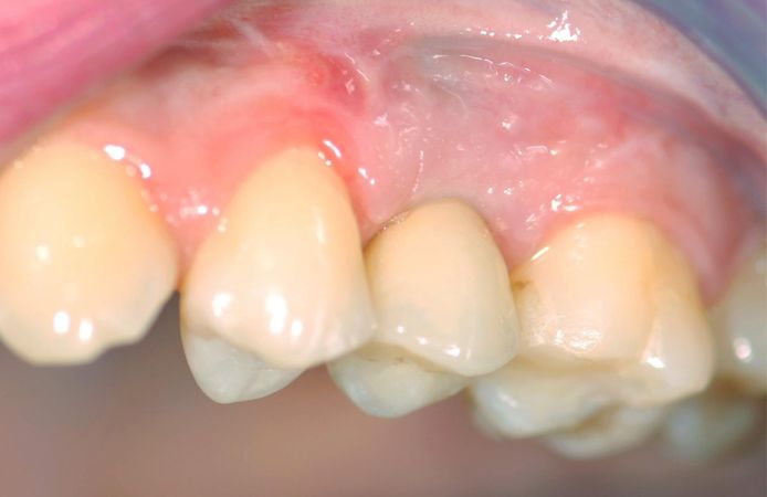 Figure 18.
