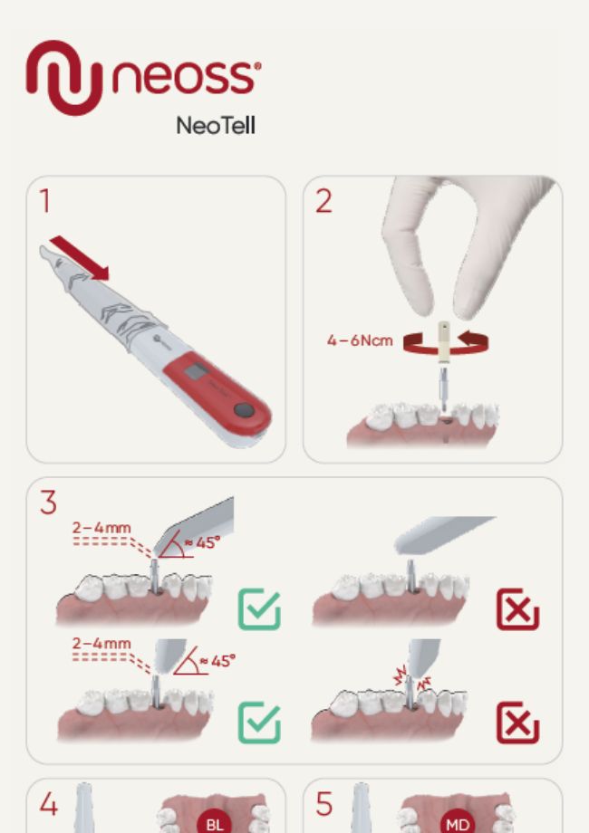 NeoTell Quick Guide