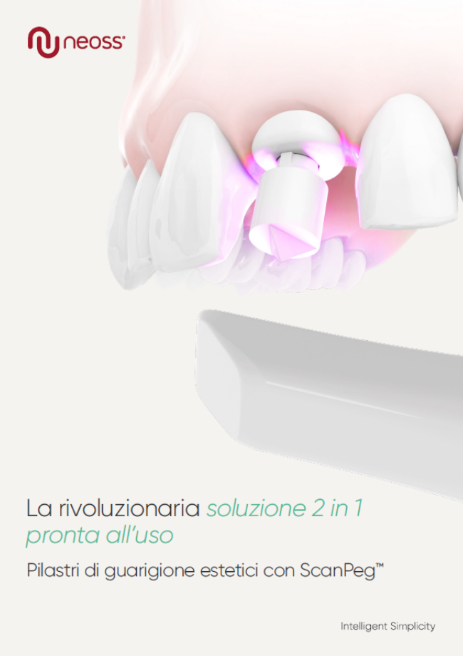 Esthetic Healing Abutment with ScanPeg