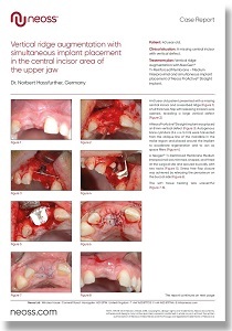 Surgical guidelines