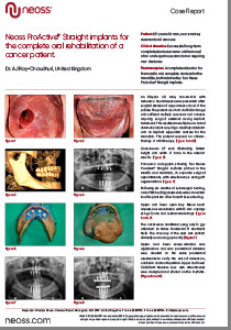 Neoss ProActive® Straight implants for the complete oral rehabilitation of a cancer patient.