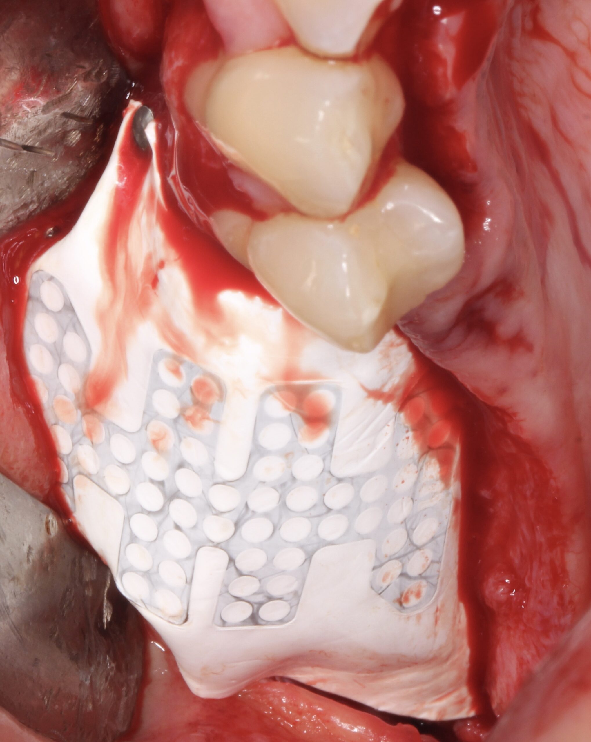 Figure 10. 