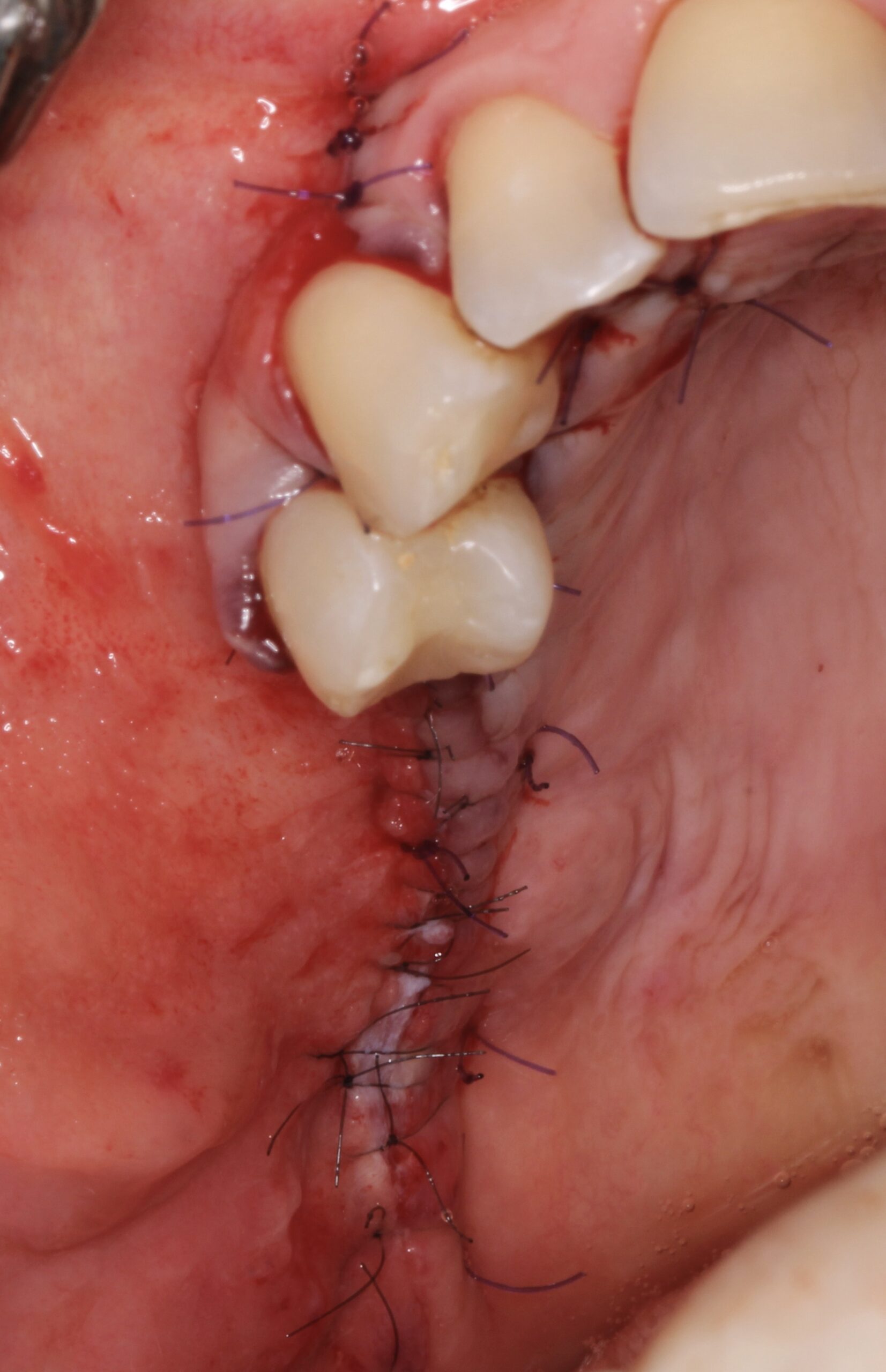 Figure 11. 