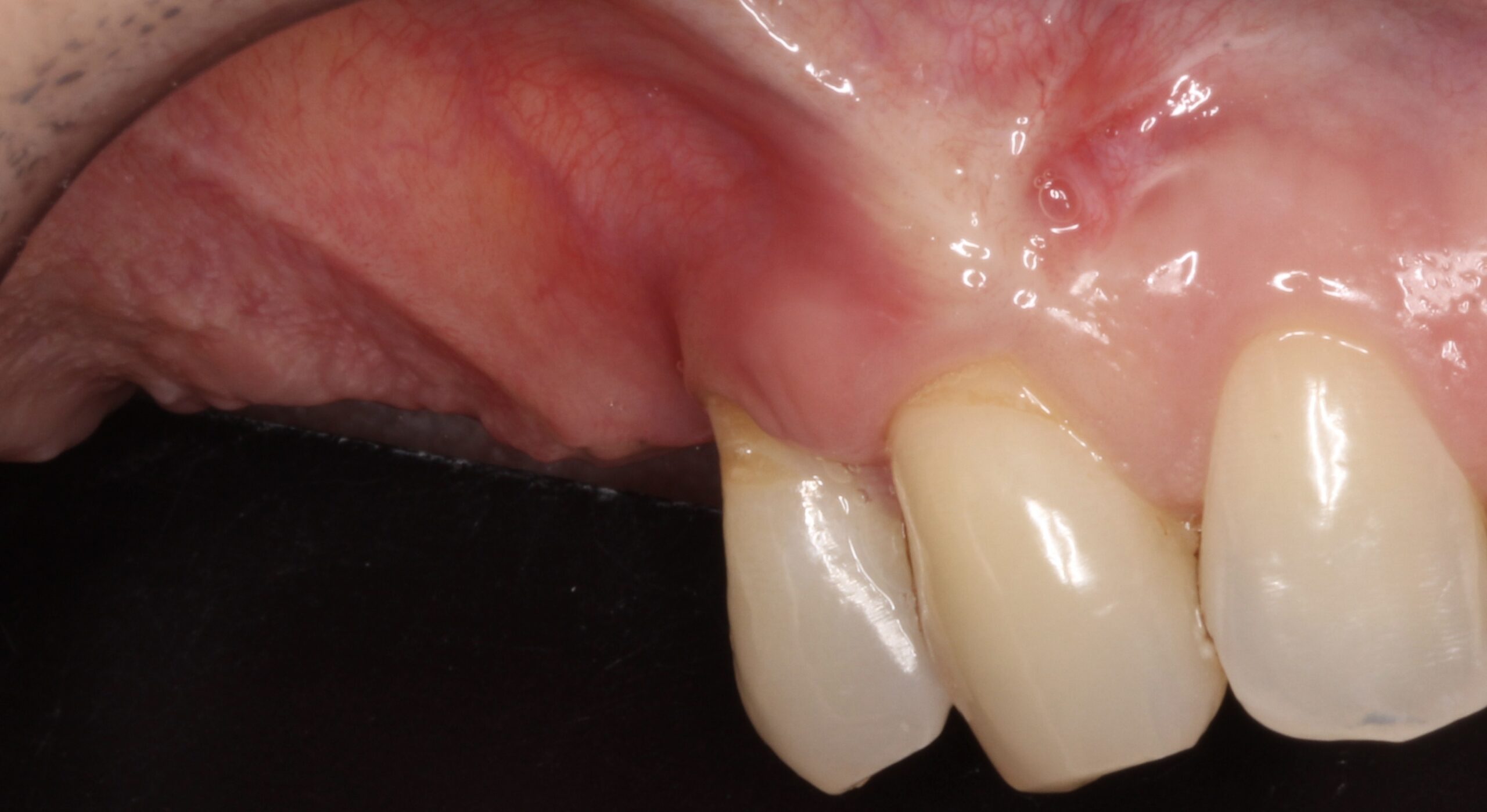 Figure 12. 