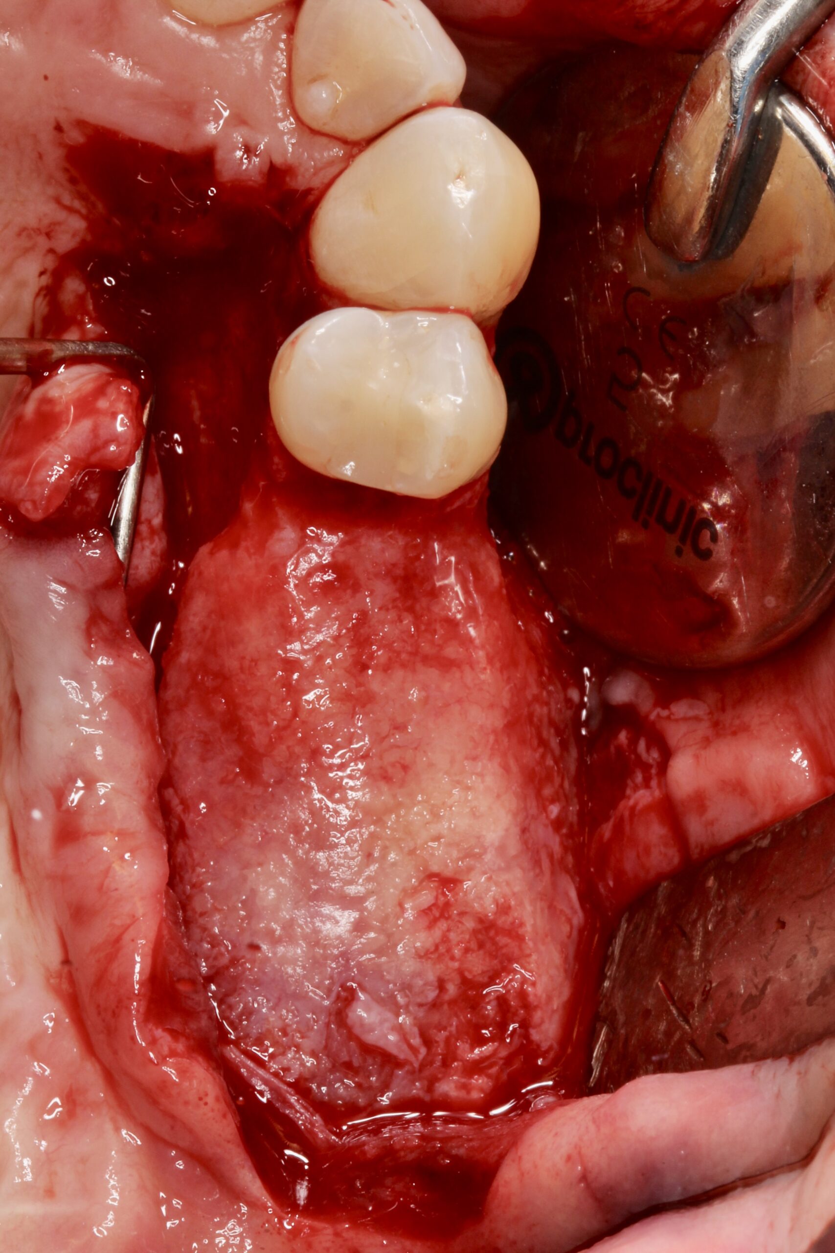 Figure 15. 
