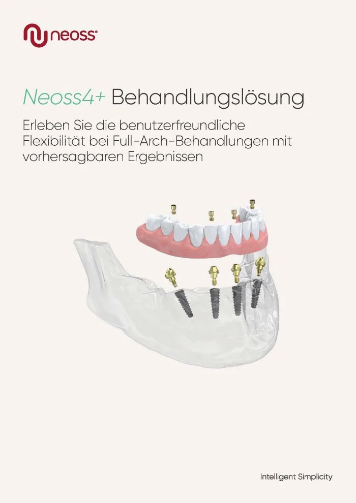 Neoss4+ Behandlungslösung