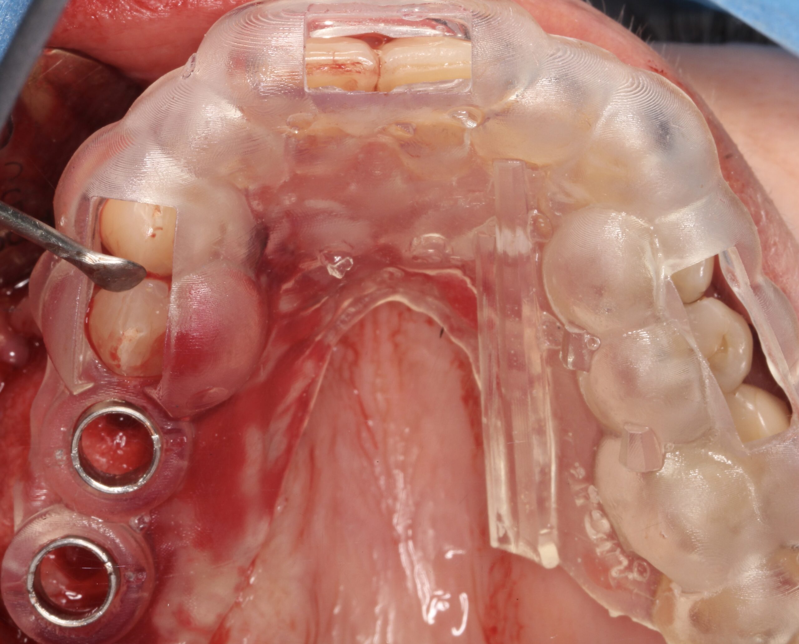 Figure 16. 