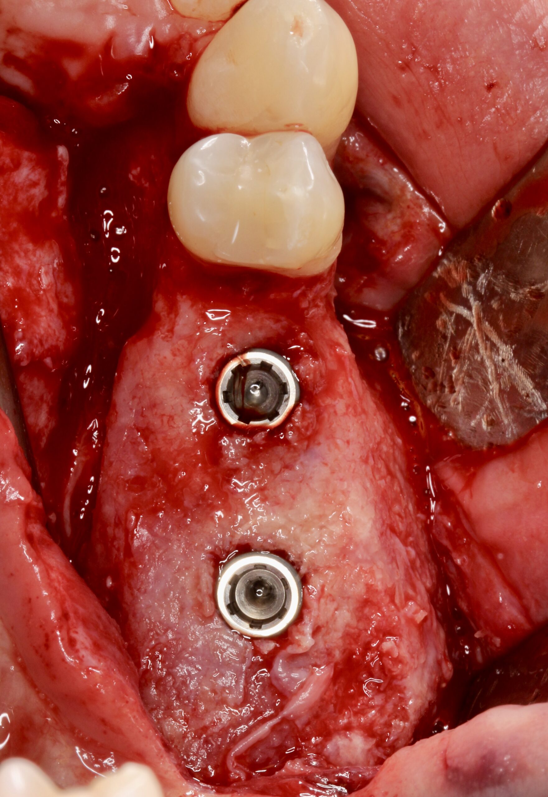 Figure 18. 