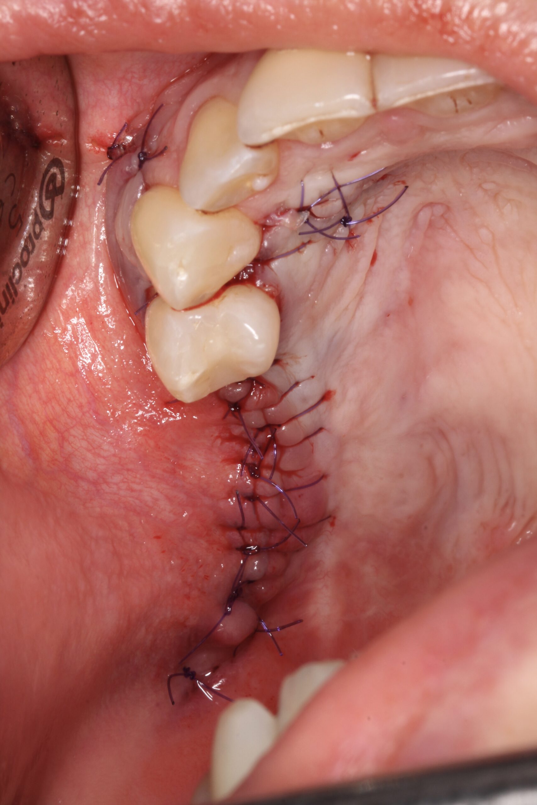 Figure 19. 