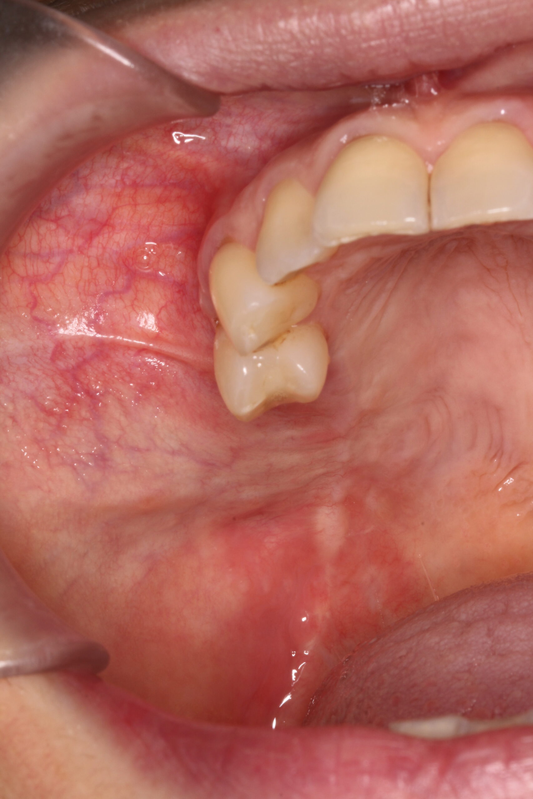 Figure 20. 
